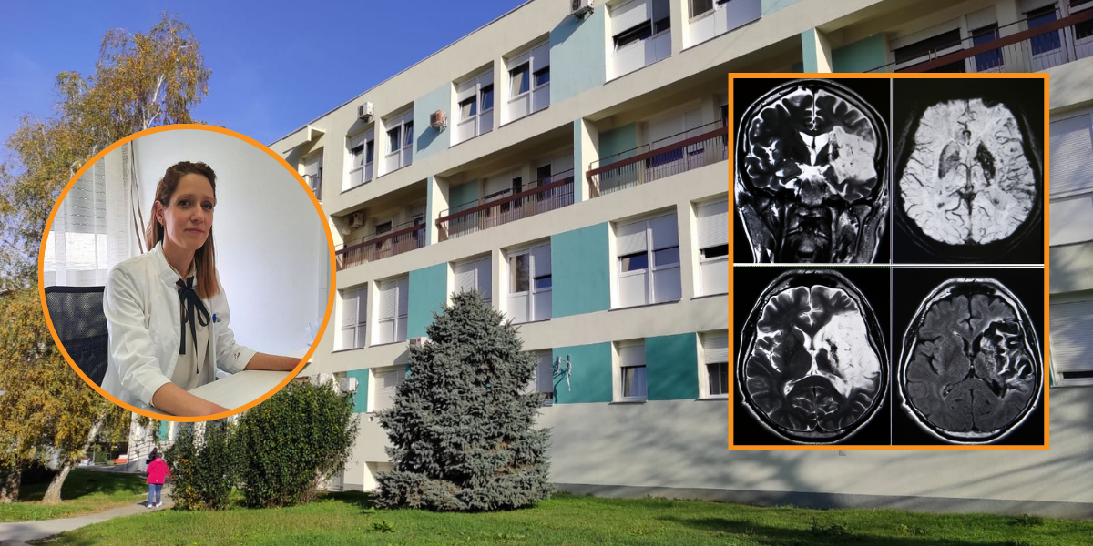 Poznata bjelovarska neurologinja ruši glavni mit o moždanom udaru: Ne, nije rezerviran za stare, danas često pogađa ovu skupinu ljudi